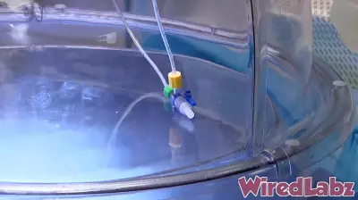 Tampa General Adopts New Device to Assess Donor Lungs Before Transplant